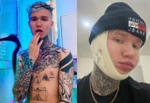 Новосибирский стилист Швец стал жертвой косметолога