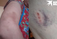 Сибирячка с собакой выжила соседей из новосибирской коммуналки