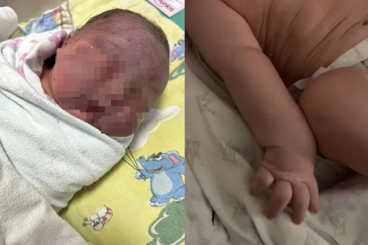 Лицо синее, рука парализована: травмирование младенца в новосибирской  больнице проверяет СКР - Новая Сибирь online