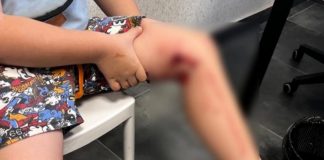 В Новосибирске возбудили уголовное дело из-за нападения стаи собак на ребенка