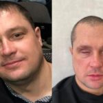 В Новосибирске охранник отеля лишился глаза после драки с пьяным байкером