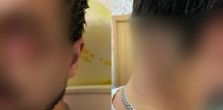 «Собака чуть не съела ему глаз»: Новосибирец натравил питомца на прохожего