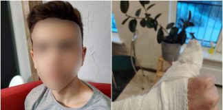 В Новосибирске родители избитого семиклассника несколько месяцев добивались возбуждения уголовного дела