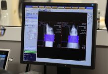 Впервые в Сибири в НГУ провели компьютерную томографию сердца у минипигов