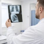 «Считаю, это врачебная ошибка»: новосибирскую школьницу с туберкулёзом лечили от пневмонии