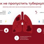 Учеников новосибирской школы массово обследуют на туберкулез