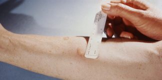 Миф о пробе Манту развеяли специалисты новосибирского Роспотребнадзора