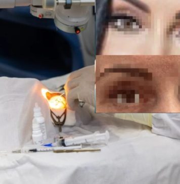 После неудачной пластической операции жительница Новосибирска подала в суд на клинику